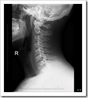 A random neck x-ray
