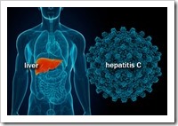 Hepatitis C